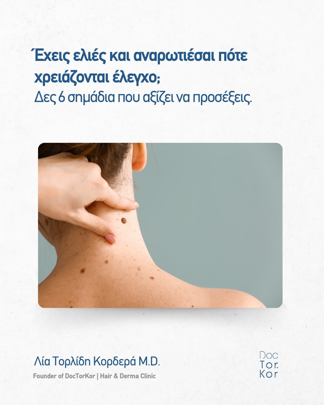 Οι ελιές δεν είναι λόγος πανικού, είναι λόγος παρακολούθησης.
Αν κάτι «διαφέρει», αν αλλάζει με τον χρόνο ή αν σε προβληματίζει, ένας δερματοσκοπικός έλεγχος μπορεί να δώσει ξεκάθαρη εικόνα και σωστή καθοδήγηση.
#doctorkor #skincareroutine #skincare #δερματοσκόπηση #χαρτογράφηση #dermatology #shelflove #loveyourskin